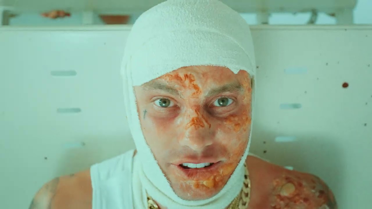 Fuck Triple J How Kerser Paved The Path For Aussie Street Rap