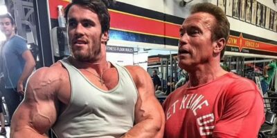 Calum von Moger shares graphic images of injuries after second-storey fall