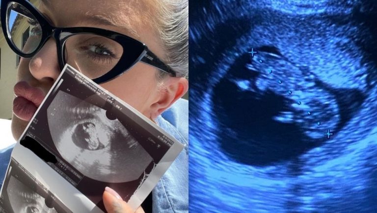 Kelly Osbourne is expecting her first baby