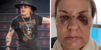 guns n' roses show mic bruised face fan